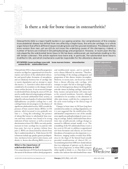 Is there a role for bone tissue in osteoarthritis?