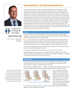Spondylolysis and Spondylolisthesis