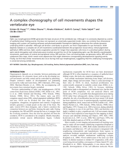 A complex choreography of cell movements shapes the vertebrate eye
