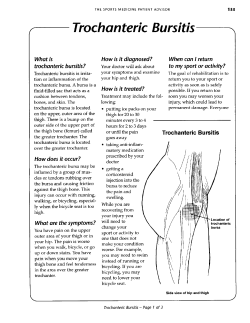 Trochanteric Bursitis - Mount Sinai Hospital