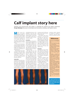 Calf implant story here
