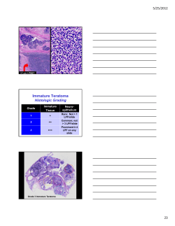 Immature Teratoma