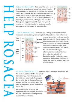 Rosacea is the name given to describe an underlying