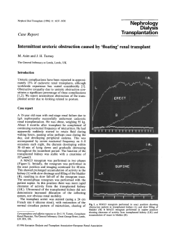 Intermittent ureteric obstruction caused by `floating`renal transplant