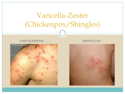 Chickenpox/Shingles