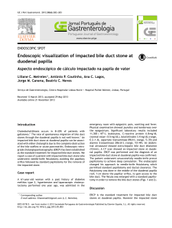 Endoscopic visualization of impacted bile duct stone at duodenal