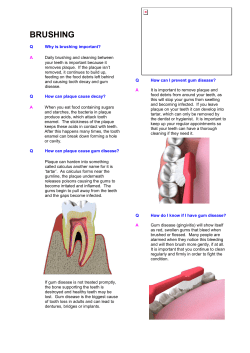 brushing - Taptonville House Dental