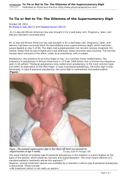 To Tie or Not to Tie: The Dilemma of the