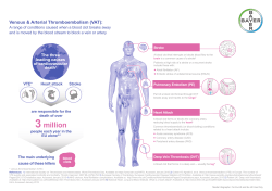 (VAT) Infographic
