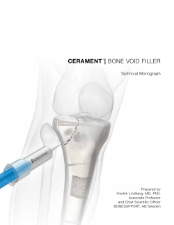 cerament&trade;| bone void filler