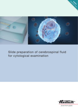 Slide preparation of cerebrospinal fluid for cytological examination