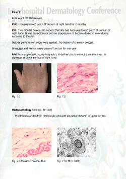 Case 7 A 47 years old Thai female. C/C Hyperpigmented patch at