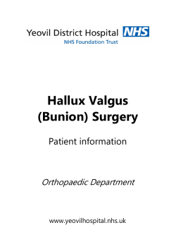 Hallux Valgus (Bunion) Surgery