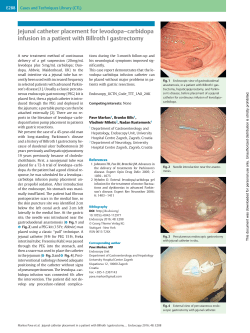 Jejunal catheter placement for levodopa&ndash;carbidopa infusion in a