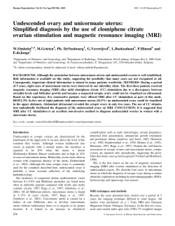 Undescended ovary and unicornuate uterus