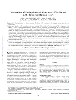 Mechanism of Pacing-Induced Ventricular Fibrillation in