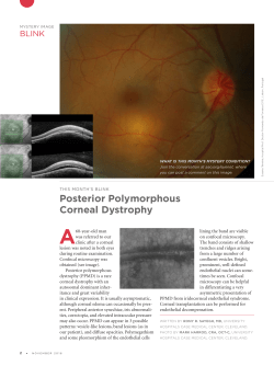 Posterior Polymorphous Corneal Dystrophy