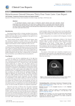 Metachronous Osteoid Osteoma Thirty