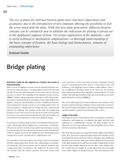 Bridge plating - AO Foundation