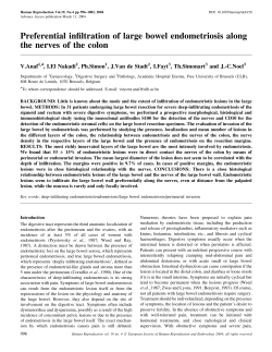 Preferential infiltration of large bowel endometriosis along the