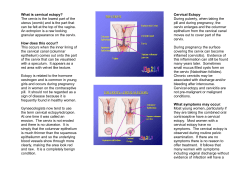 Cervical Ectopy
