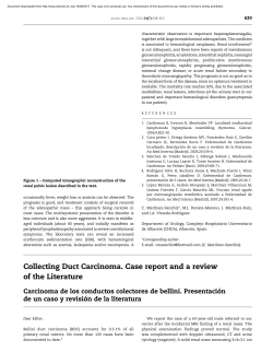 Collecting Duct Carcinoma. Case report and a review of