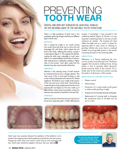 preventing - Demajo Dental