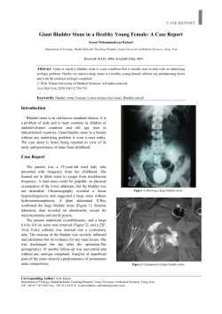 Giant Bladder Stone in a Healthy Young Female: A Case Report