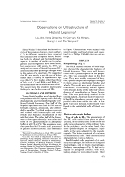 Observations on Ultrastructure of Histoid Lepromal