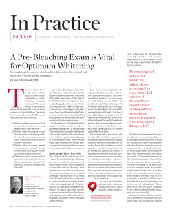 A Pre-Bleaching Exam is Vital for Optimum Whitening