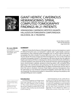 GIANT HEPATIC CAVERNOUS HEMANGIOMAS: SPIRAL