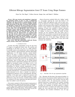 Efficient Ribcage Segmentation from CT Scans Using
