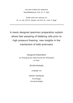 A newly designed specimen preparation system