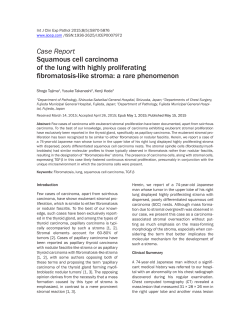 Case Report Squamous cell carcinoma of the lung with highly