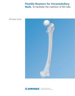 Flexible Reamers for Intramedullary Nails TG