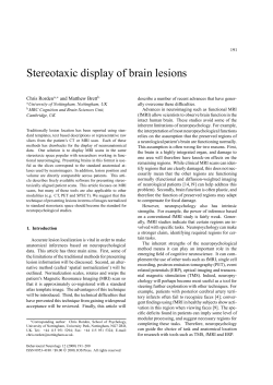 Stereotaxic display of brain lesions