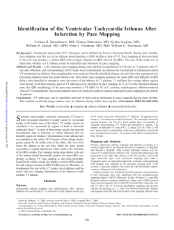 Identification of the Ventricular Tachycardia Isthmus
