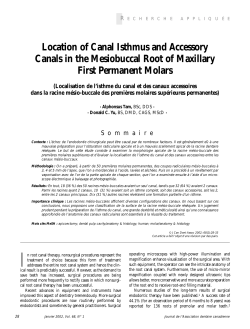 Location of Canal Isthmus and Accessory Canals in the Mesiobuccal