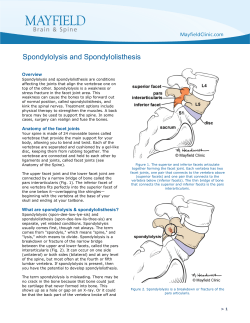 Spondylolysis and Spondylolisthesis
