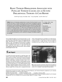 right thyroid hemiagenesis associated with papillary thyroid cancer