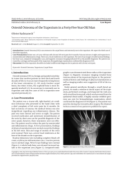 Osteoid Osteoma of the Trapezium in a Forty-Five-Year