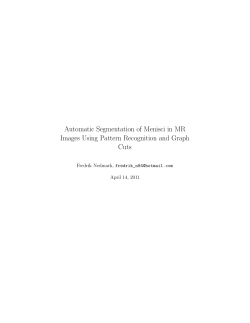 Automatic Segmentation of Menisci in MR Images Using Pattern
