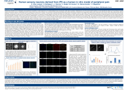Human sensory neurons derived from iPS as a human in vitro model