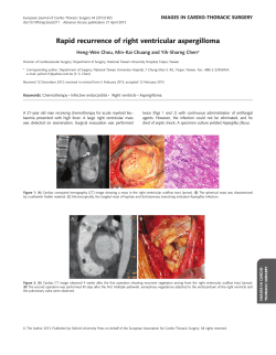 Rapid recurrence of right ventricular aspergilloma