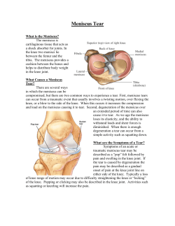 Meniscus Tear