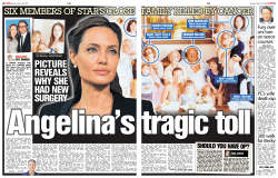 picture reveals why she had new surgery - Bertrand