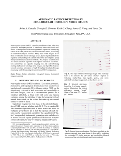 AUTOMATIC LATTICE DETECTION IN NEAR