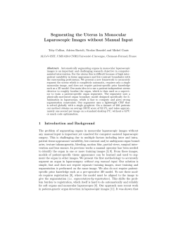 Segmenting the Uterus in Monocular Laparoscopic Images