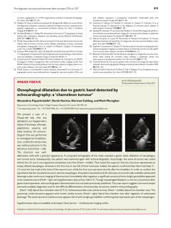 Oesophageal dilatation due to gastric band detected by