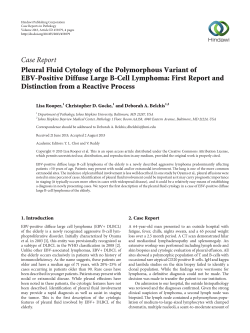 Pleural Fluid Cytology of the Polymorphous Variant of EBV